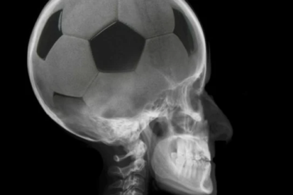 Futebol e Neurociência: Como o Cérebro Impacta o Jogo