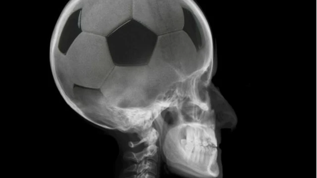 Futebol e Neurociência: Como o Cérebro Impacta o Jogo